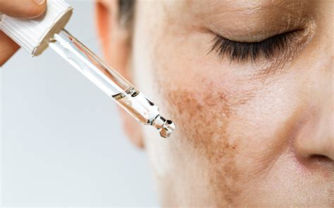 Why Dermatologists Love Recommending Luxealina